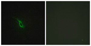 Anti-Adrenergic Receptor &#945;-2A antibody produced in rabbit affinity isolated antibody