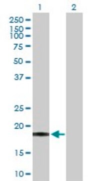 Anti-PSCA antibody produced in rabbit purified immunoglobulin, buffered aqueous solution