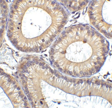 Anti-RIG-1 antibody produced in rabbit purified antibody (DEAE)