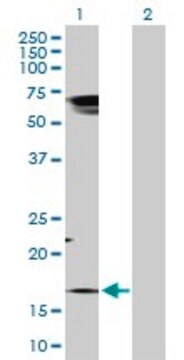 Anti-TAC1 antibody produced in rabbit purified immunoglobulin, buffered aqueous solution