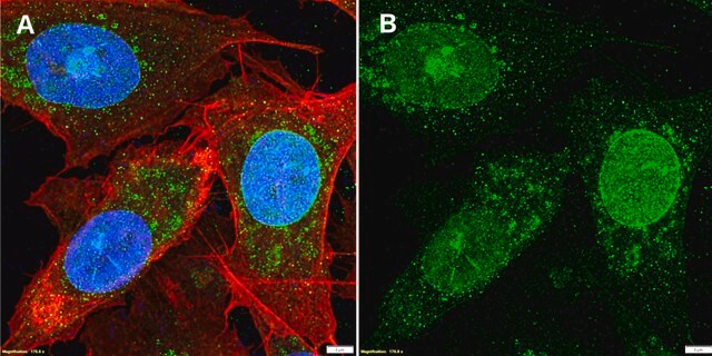 Anti-CXCL1/GRO&#945; Antibody, clone 2J19 ZooMAb&#174; Rabbit Monoclonal recombinant, expressed in HEK 293 cells