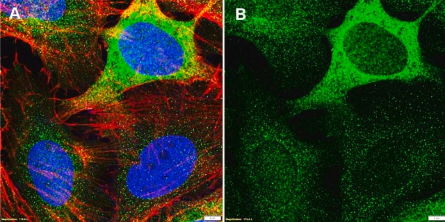 Anti-Stathmin Antibody, clone 1F5 ZooMAb&#174; Rabbit Monoclonal recombinant, expressed in HEK 293 cells