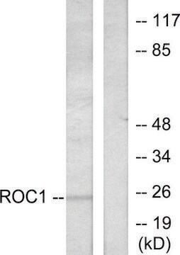 Anti-RIT1 antibody produced in rabbit affinity isolated antibody