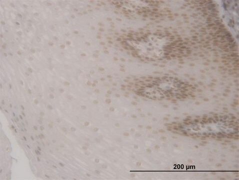 Monoclonal Anti-FOXO3A antibody produced in mouse clone 1F6, purified immunoglobulin, buffered aqueous solution