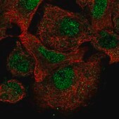 Anti-CARD8 antibody produced in rabbit Prestige Antibodies&#174; Powered by Atlas Antibodies, affinity isolated antibody, buffered aqueous glycerol solution