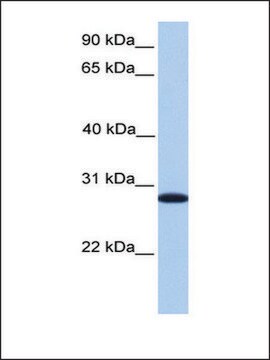 Anti-CDKN3 antibody produced in rabbit affinity isolated antibody
