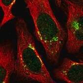 Anti-RNPEP antibody produced in rabbit Prestige Antibodies&#174; Powered by Atlas Antibodies, affinity isolated antibody