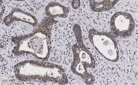 Anti-RAR-alpha Antibody, clone 3L14, ZooMAb&#174; Rabbit Monoclonal recombinant, expressed in HEK 293 cells