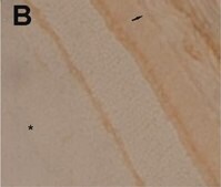 Anti-Na+K+ ATPase &#945;-2 Antibody serum, Upstate&#174;