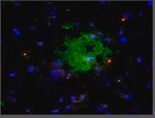 Anti-A&#946;-42 Antibody, oligomeric (VIA) serum, from rabbit