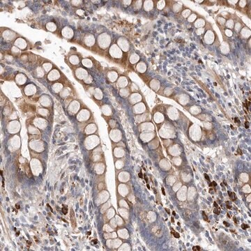 Anti-ATXN3L antibody produced in rabbit Prestige Antibodies&#174; Powered by Atlas Antibodies, affinity isolated antibody, buffered aqueous glycerol solution