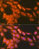Anti-PGE receptor EP2 (PTGER2) antibody produced in rabbit