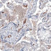Monoclonal Anti-AFP antibody produced in mouse Prestige Antibodies&#174; Powered by Atlas Antibodies, clone CL9772, purified immunoglobulin, buffered aqueous glycerol solution