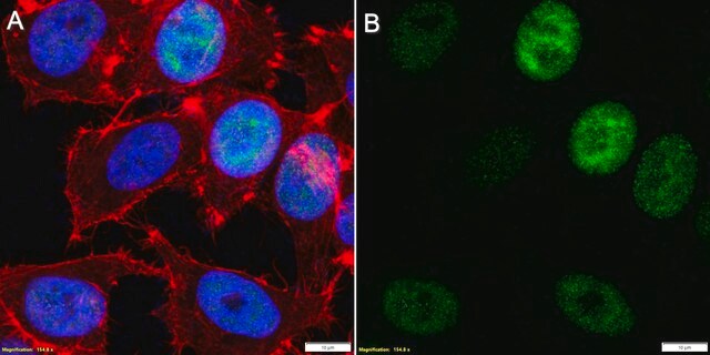 Anti-Phosphoepitope SR Antibody, clone 1H4 ZooMAb&#174; Mouse Monoclonal recombinant, expressed in HEK 293 cells