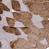 Monoclonal Anti-MYH6 antibody produced in mouse Prestige Antibodies&#174; Powered by Atlas Antibodies, clone CL2162, purified immunoglobulin, buffered aqueous glycerol solution