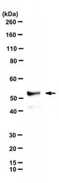 Anti-RIPK3/RIP3 Antibody, clone 8G7