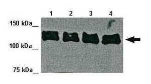 Anti-PLD2 antibody produced in rabbit affinity isolated antibody