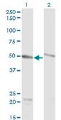 Monoclonal Anti-TUBA6 antibody produced in mouse clone 1D2-H5, purified immunoglobulin, buffered aqueous solution