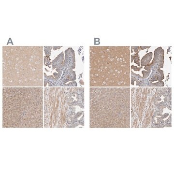 Anti-MPRIP antibody produced in rabbit Prestige Antibodies&#174; Powered by Atlas Antibodies, affinity isolated antibody, buffered aqueous glycerol solution, Ab1