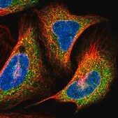 Anti-PRNP antibody produced in rabbit Prestige Antibodies&#174; Powered by Atlas Antibodies, affinity isolated antibody, buffered aqueous glycerol solution