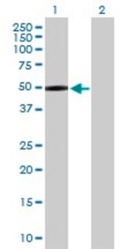 Anti-MASP1 antibody produced in rabbit purified immunoglobulin, buffered aqueous solution