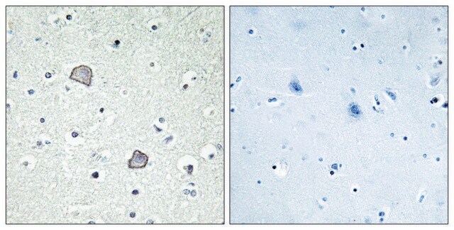 Anti-EDG2 antibody produced in rabbit affinity isolated antibody