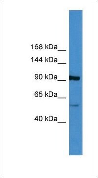 Anti-LPA antibody produced in rabbit affinity isolated antibody