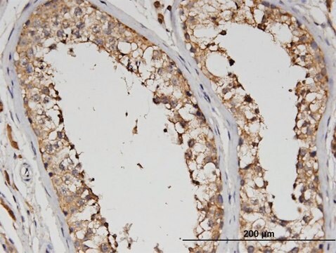 Monoclonal Anti-SLC13A5 antibody produced in mouse clone 2G4, purified immunoglobulin, buffered aqueous solution