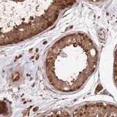 Anti-PSMA1 antibody produced in rabbit Prestige Antibodies&#174; Powered by Atlas Antibodies, affinity isolated antibody, buffered aqueous glycerol solution