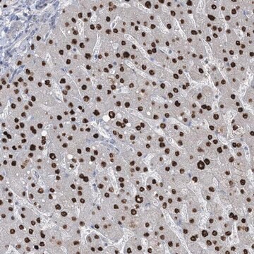 Anti-TFPT antibody produced in rabbit Prestige Antibodies&#174; Powered by Atlas Antibodies, affinity isolated antibody, buffered aqueous glycerol solution