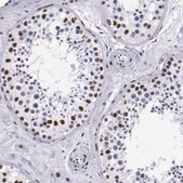 Anti-MECP2 antibody produced in rabbit Ab1, Prestige Antibodies&#174; Powered by Atlas Antibodies, affinity isolated antibody, buffered aqueous glycerol solution