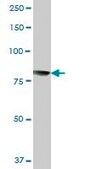 Anti-CAPN1 antibody produced in mouse purified immunoglobulin, buffered aqueous solution