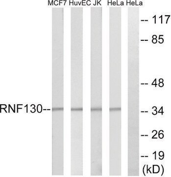 Anti-RNF130 antibody produced in rabbit affinity isolated antibody