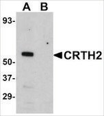 Anti-CRTH2 antibody produced in rabbit affinity isolated antibody, buffered aqueous solution