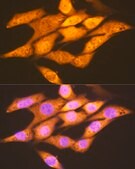 Anti-FGF1 Antibody, clone 3X3E5, Rabbit Monoclonal