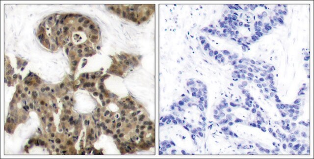 Anti-EIF4EBP1 (Ab-45) antibody produced in rabbit affinity isolated antibody