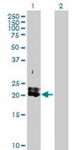 Anti-PDGFA antibody produced in rabbit purified immunoglobulin, buffered aqueous solution