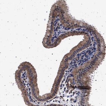 Anti-MAP3K2 antibody produced in rabbit Prestige Antibodies&#174; Powered by Atlas Antibodies, affinity isolated antibody, buffered aqueous glycerol solution
