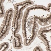 Anti-RBM25 antibody produced in rabbit Prestige Antibodies&#174; Powered by Atlas Antibodies, affinity isolated antibody, buffered aqueous glycerol solution