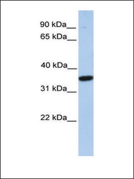 Anti-MOGAT1 antibody produced in rabbit affinity isolated antibody