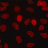 A549 Cells GFP-CTNNB1 RFP-LMNB1