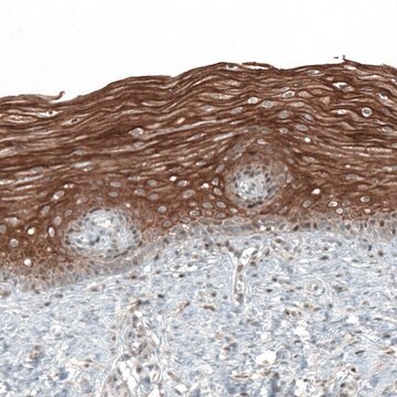 Anti-PAPD5 antibody produced in rabbit Prestige Antibodies&#174; Powered by Atlas Antibodies, affinity isolated antibody, buffered aqueous glycerol solution