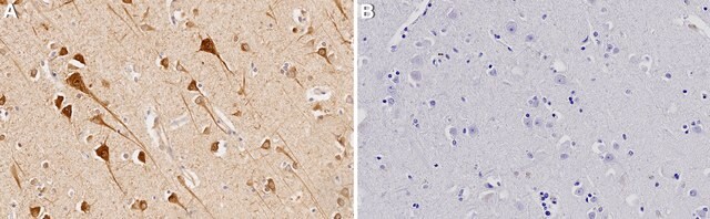 Anti-CYP46A1 Antibody, clone 1C20 ZooMAb&#174; Rabbit Monoclonal recombinant, expressed in HEK 293 cells