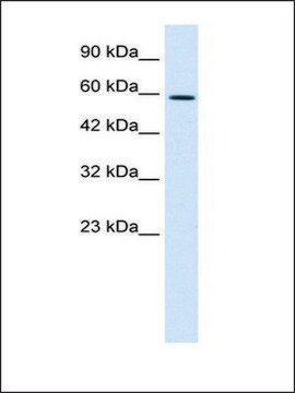 Anti-TBX4 antibody produced in rabbit affinity isolated antibody