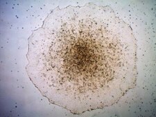 Stem Cell Qualified ECM Gel Stem cell qualified basement membrane extract (BME) for human ES and iPS cell culture.