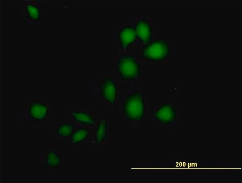 Anti-DSCR1 antibody produced in mouse purified immunoglobulin, buffered aqueous solution