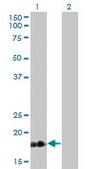 Monoclonal Anti-TNNC1 antibody produced in mouse clone 1F8-A9, purified immunoglobulin, buffered aqueous solution