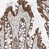 Anti-ETHE1 antibody produced in rabbit Prestige Antibodies&#174; Powered by Atlas Antibodies, affinity isolated antibody, buffered aqueous glycerol solution, ab2