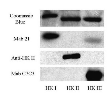 Anti-Hexokinase Type II Antibody Chemicon&#174;, from rabbit