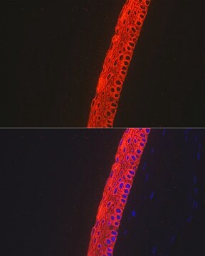 Anti-Cytokeratin 12 (KRT12) Antibody, clone 2M1K10, Rabbit Monoclonal